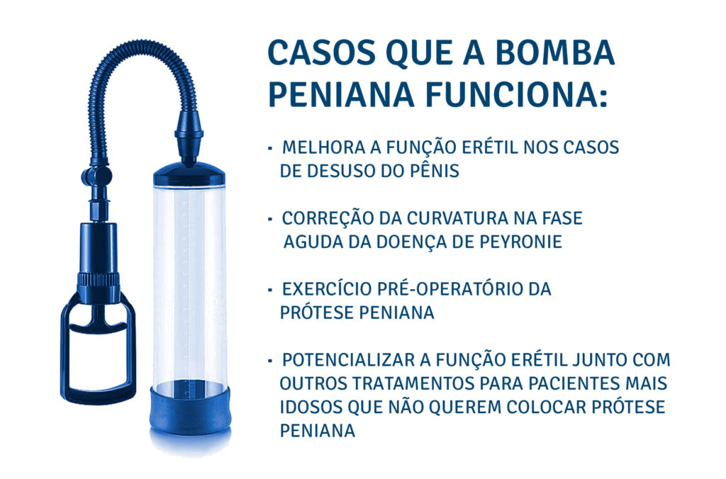 Casos que a bomba peniana funciona Casos que a bomba peniana funciona.