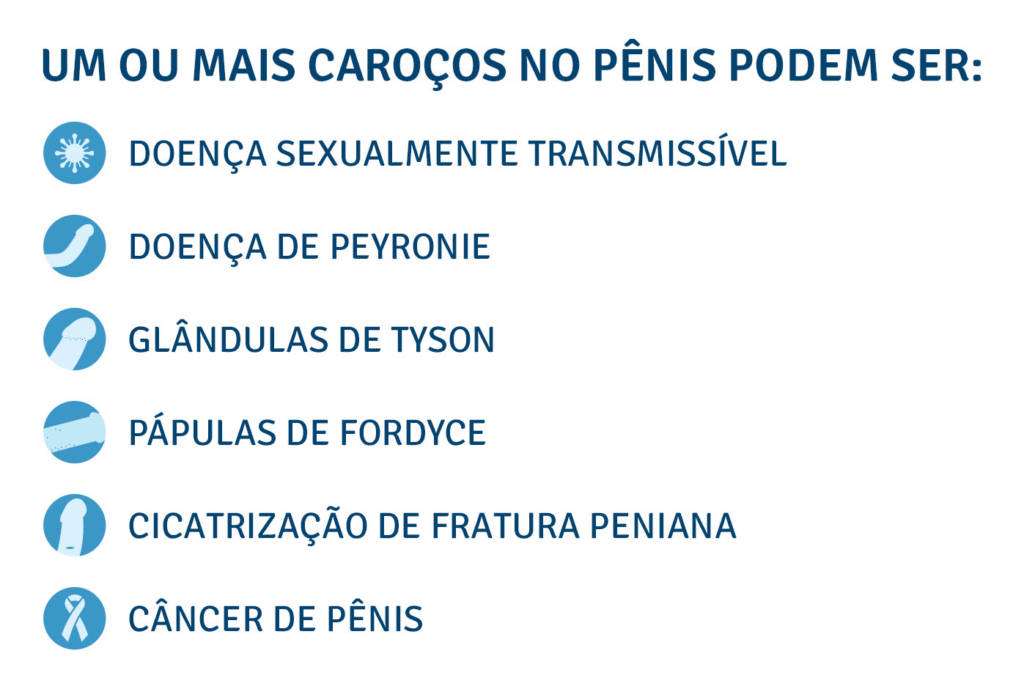 Um ou mais caroços no pênis Um ou mais caroços no pênis podem ser:
- Doença sexualmente transmissível;
- Doença de Peyronie;
- Glândulas de Tyson;
- Pápulas de Fordyce;
- Cicatrização de fratura peniana;
- Câncer de pênis
