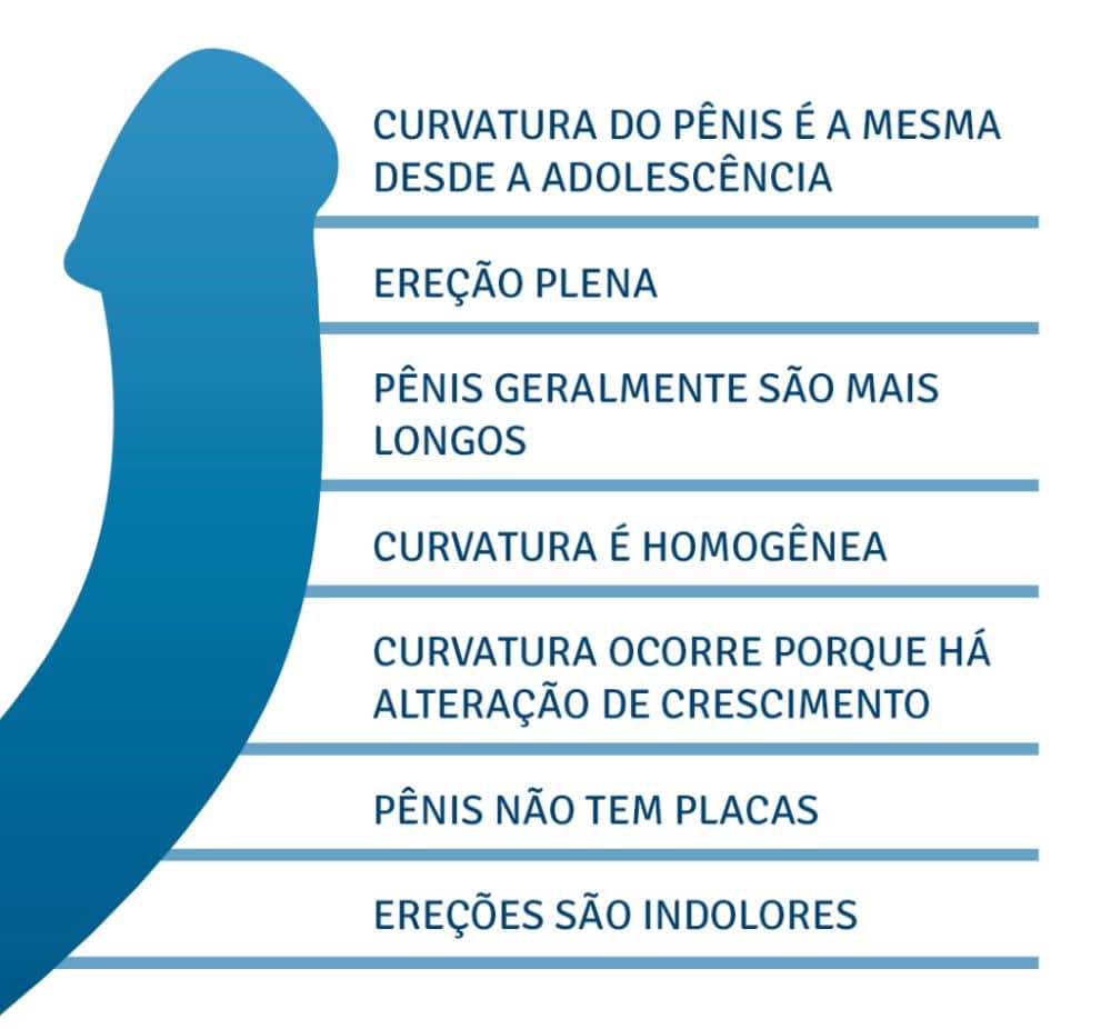 Pênis curvo congênito Características do pênis curvo congênito CURVATURA DO PÊNIS É A MESMA DESDE A ADOLESCÊNCIA EREÇÃO PLENA PÊNIS GERALMENTE SÃO MAIS LONGOS CURVATURA É HOMOGÊNEA CURVATURA OCORRE PORQUE HÁ ALTERAÇÃO DE CRESCIMENTO PÊNIS NÃO TEM PLACAS EREÇÕES SÃO INDOLORES