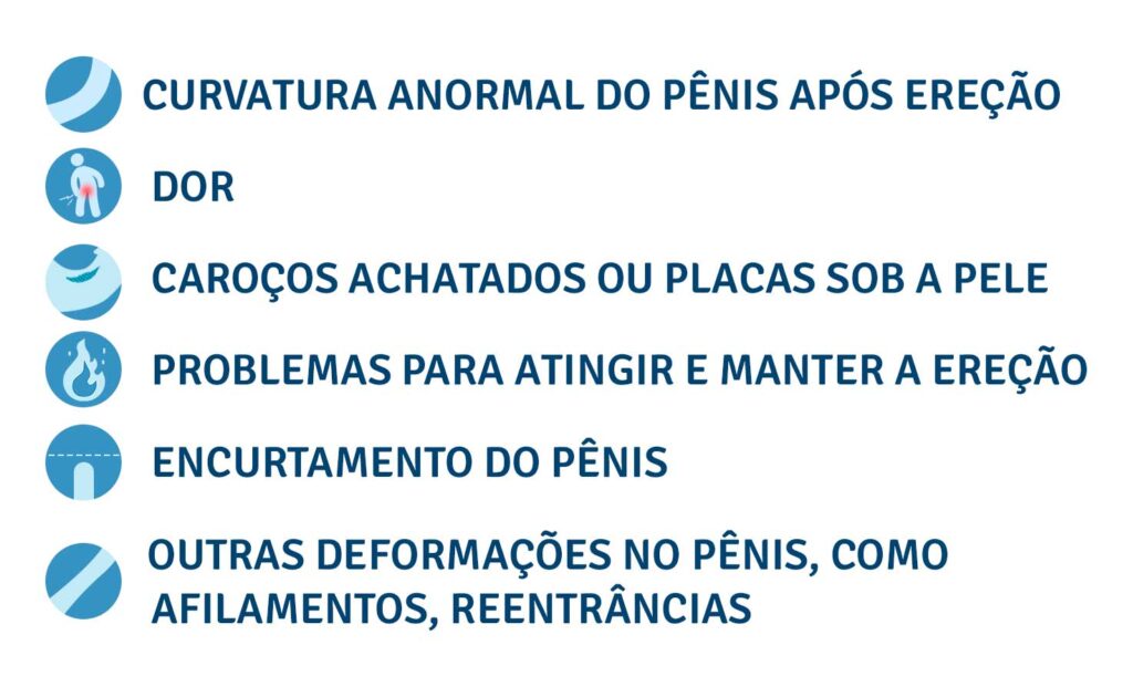 Sintomas da Doença de Peyronie: Sintomas da Doença de Peyronie: curvatura anormal do pênis após ereção; dor; caroços achatados ou placas sob a pele, problemas para atingir e manter a ereção; encurtamento do pênis; outras deformações no pênis, como afilamentos, reentrâncias