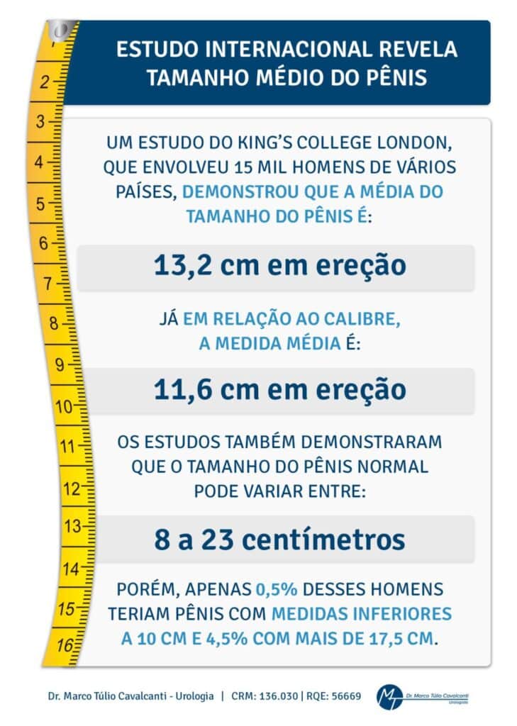 Tamanho médio do pênis ESTUDO INTERNACIONAL REVELA TAMANHO MÉDIO DO PÊNIS
UM ESTUDO DO KING'S COLLEGE LONDON, QUE ENVOLVEU 15 MIL HOMENS DE VÁRIOS PAÍSES, DEMONSTROU QUE A MÉDIA DO TAMANHO DO PÊNIS É:
13,2 cm em ereção
JÁ EM RELAÇÃO AO CALIBRE, A MEDIDA MÉDIA É:
11,6 cm em ereção
OS ESTUDOS TAMBÉM DEMONSTRARAM QUE O TAMANHO DO PÊNIS NORMAL PODE VARIAR ENTRE:
8 a 23 centímetros
PORÉM, APENAS 0,5% DESSES HOMENS TERIAM PÊNIS COM MEDIDAS INFERIORES A 10 CM E 4,5% COM MAIS DE 17,5 CM.
Dr. Marco Túlio Cavalcanti - Urologia | CRM: 136.030 | RQE: 56669
