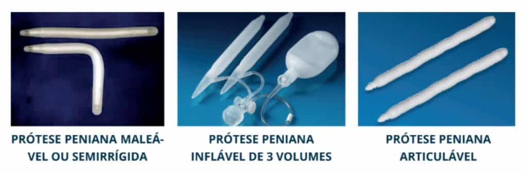 PRÓTESE PENIANA MALEÁVEL OU SEMIRRÍGIDA PRÓTESE PENIANA INFLÁVEL DE 3 VOLUMES PRÓTESE PENIANA ARTICULÁVEL