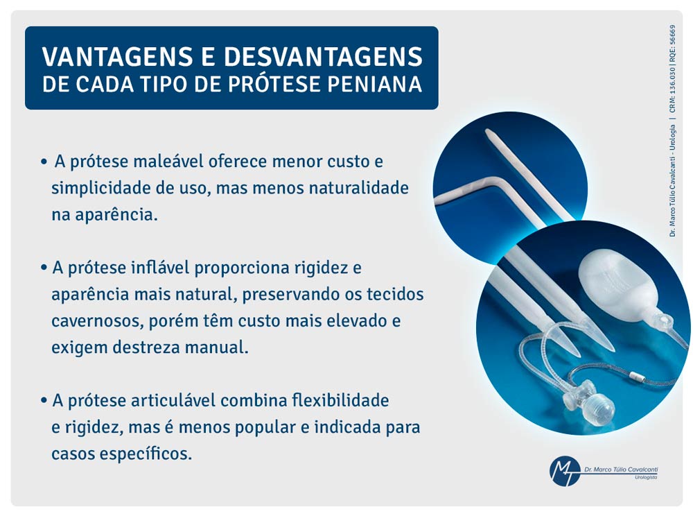 antagens e desvantagens de cada tipo de prótese peniana? Arte - Vantagens e desvantagens de cada tipo de prótese peniana?
A prótese maleável oferece menor custo e simplicidade de uso, mas menos naturalidade na aparência.
A prótese inflável proporciona rigidez e aparência mais natural, preservando os tecidos cavernosos, porém têm custo mais elevado e exigem destreza manual.
A prótese articulável combina flexibilidade e rigidez, mas é menos popular e indicada para casos específicos.