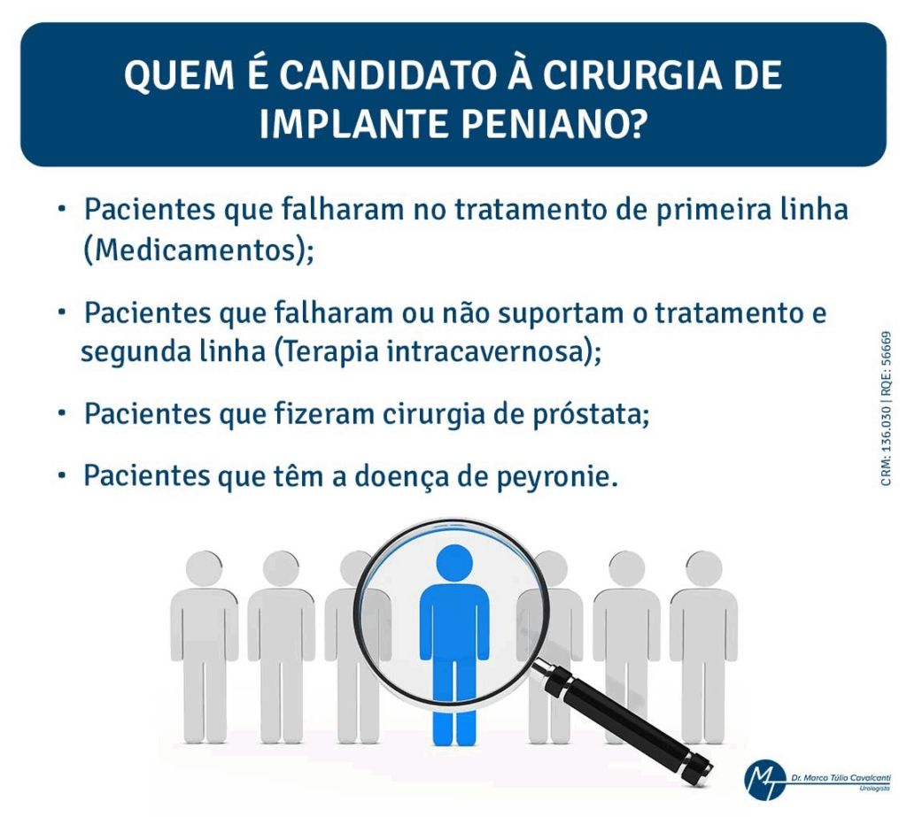 Quem é candidato à cirurgia de implante peniano Quem é candidato à cirurgia de implante peniano?
- Pacientes que falharam no tratamento de primeira linha (medicamentos
- Pacientes que falharam ou não suportaram o tratamento de segunda linha (terapia intracavernosa);
- Pacientes que fizeram cirurgia de próstata;
- Pacientes que têm doença de Peyronie.